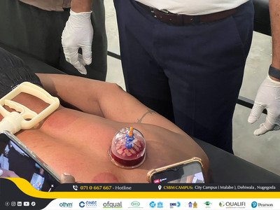cupping therapy workshop csbm campus