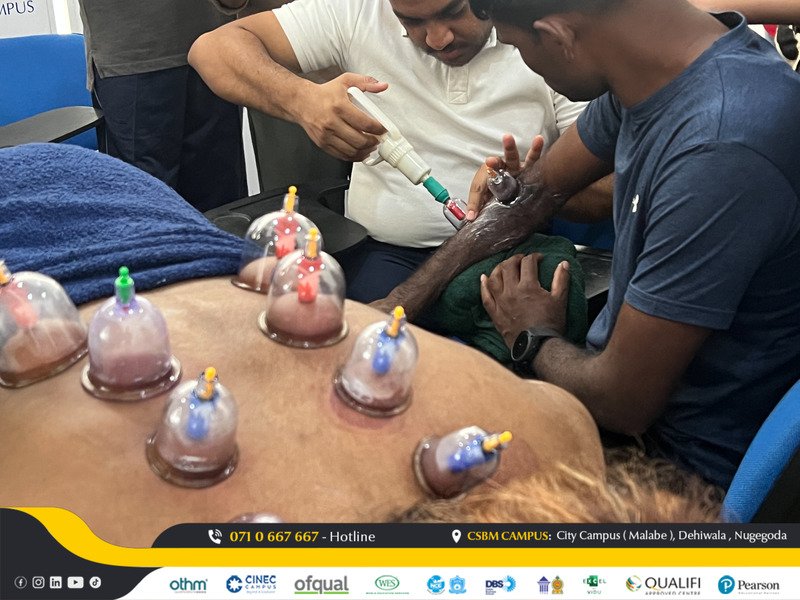 cupping therapy workshop csbm campus